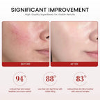 Centella Asiatica Face Cream Soothing Moisturizer Skin Barrier Repair Cica Cream Deep Hydration Anti Redness Korean Skin Care